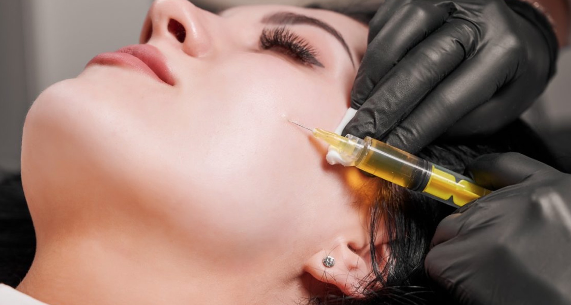 PRP Therapy