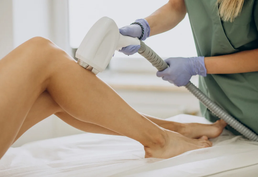 Laser Hair Removal Candela