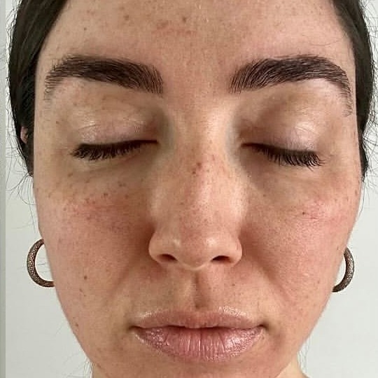Before: BBL HEROic (décolleté)