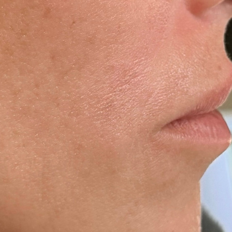 After: Luminance Face Reset