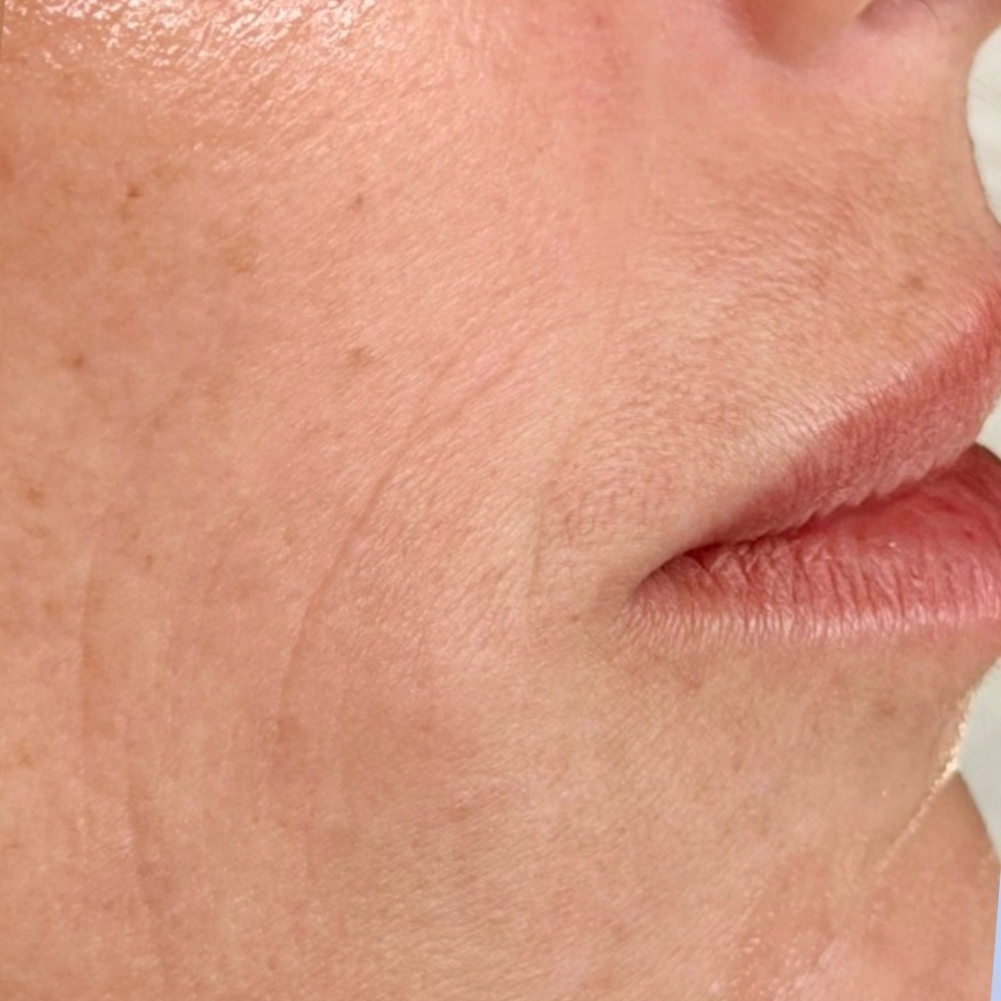 Before: Luminance Face Reset